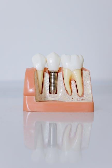 Dental equipment