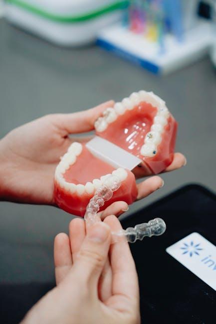 Invisalign clear aligners