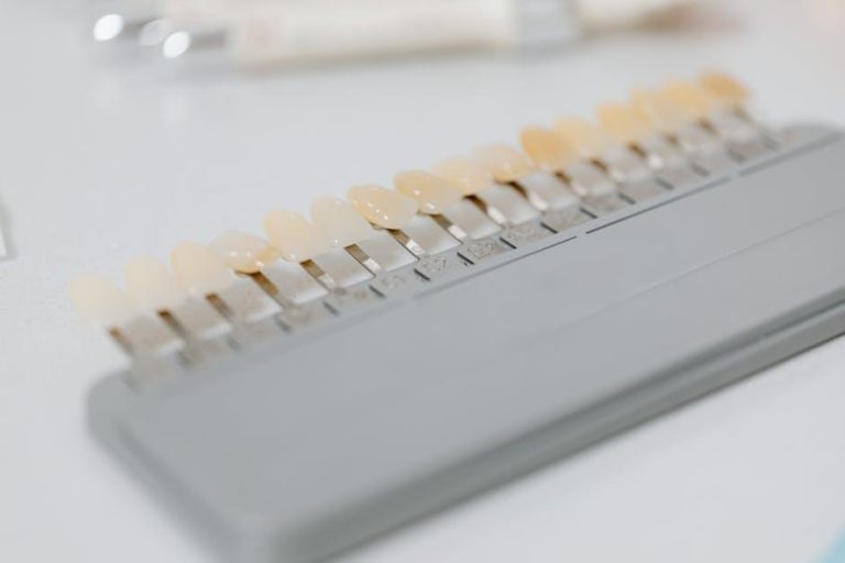 Winning smile: all you need to know about dental veneers – scmp.com