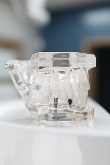 smart dental implants