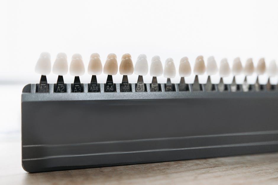 snap-on veneers