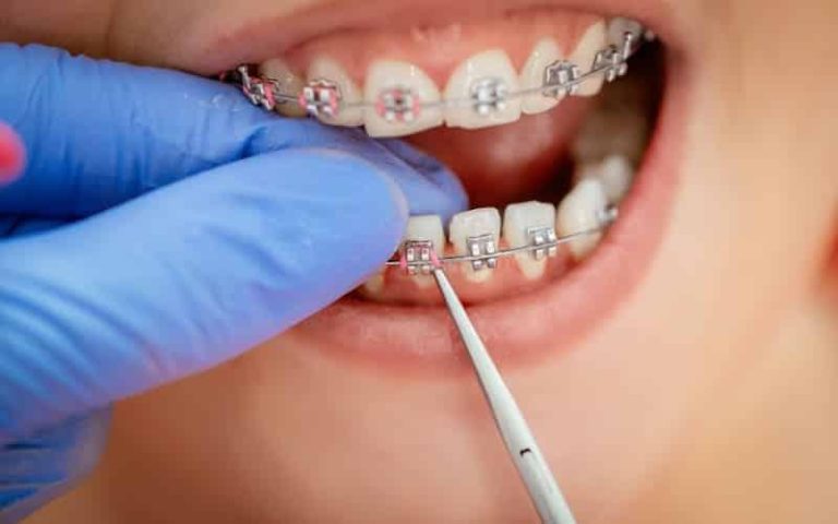 Mills Dental Group Adds FASTBRACES® to Expand Orthodontic Options for Houston Patients – openPR.com