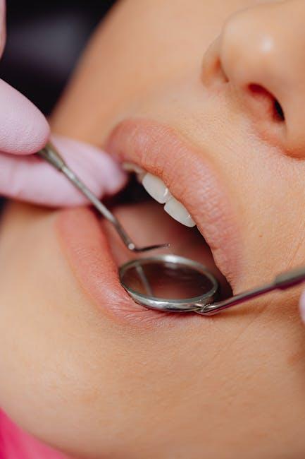Dental equipment
