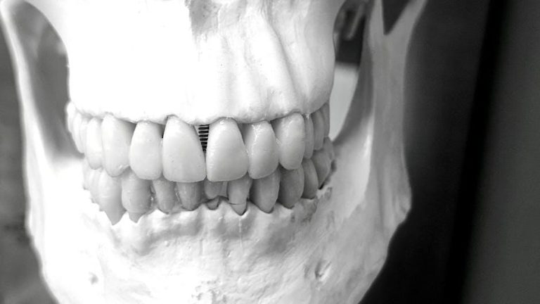 Telangana Dental Council Clarifies: Oral and Maxillofacial Surgeons Are Qualified to Perform Facial Aesthetic Procedures and Hair Transplantation – StartupNews.fyi