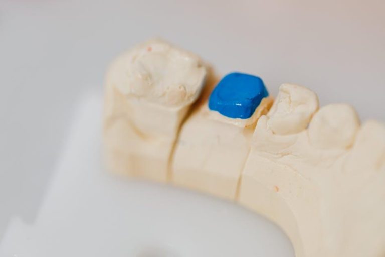 Meet our new Restorative Dentistry Expert, Infinity Dental – WOODTV.com