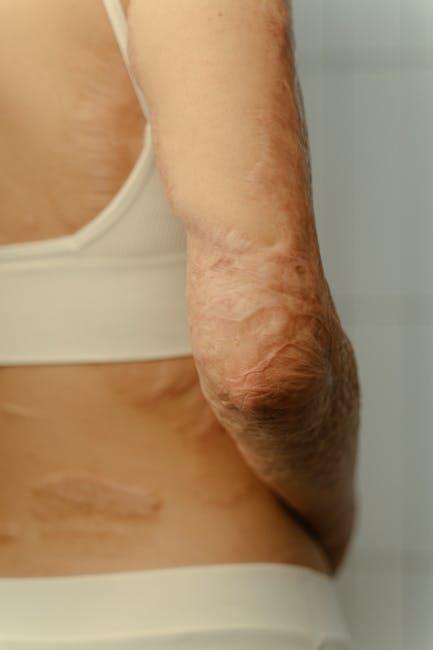lost tissue regeneration