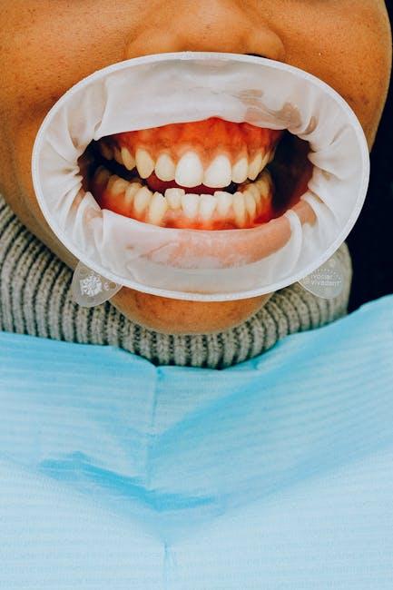 non-traumatic dental conditions