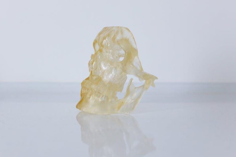 What makes dental 3D printing the new normal in dentistry? – Med-Tech Insights