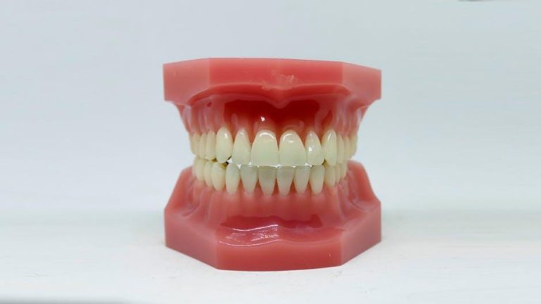 Dental aid helps cancer patients regain health and dignity – soapboxmedia.com
