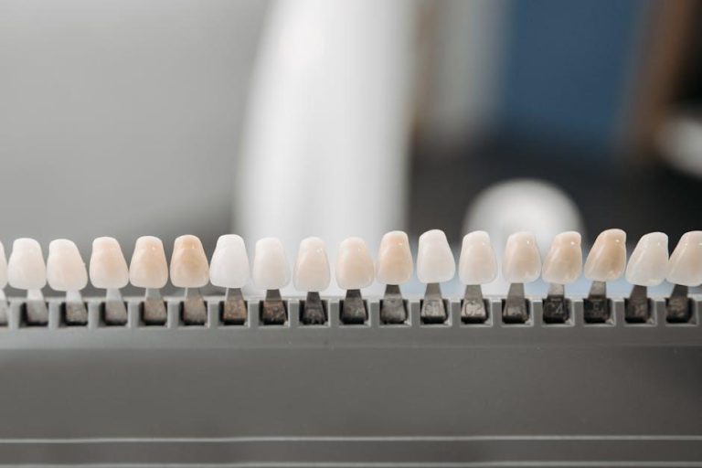 The Cost of a Perfect Smile – SELF Magazine
