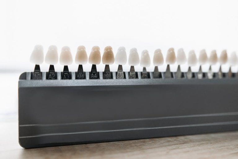 What Are Veneers? Everything to Know About the Procedure, According to Cosmetic Dentists – Well+Good