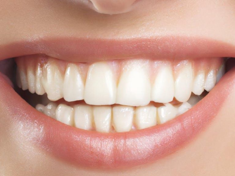 Have you noticed that everyone’s teeth are a little too perfect? – The Washington Post