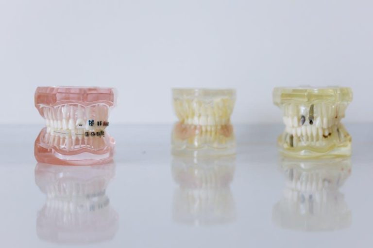 Dental Implants & Cosmetic Dentistry of Towson – Baltimore Magazine
