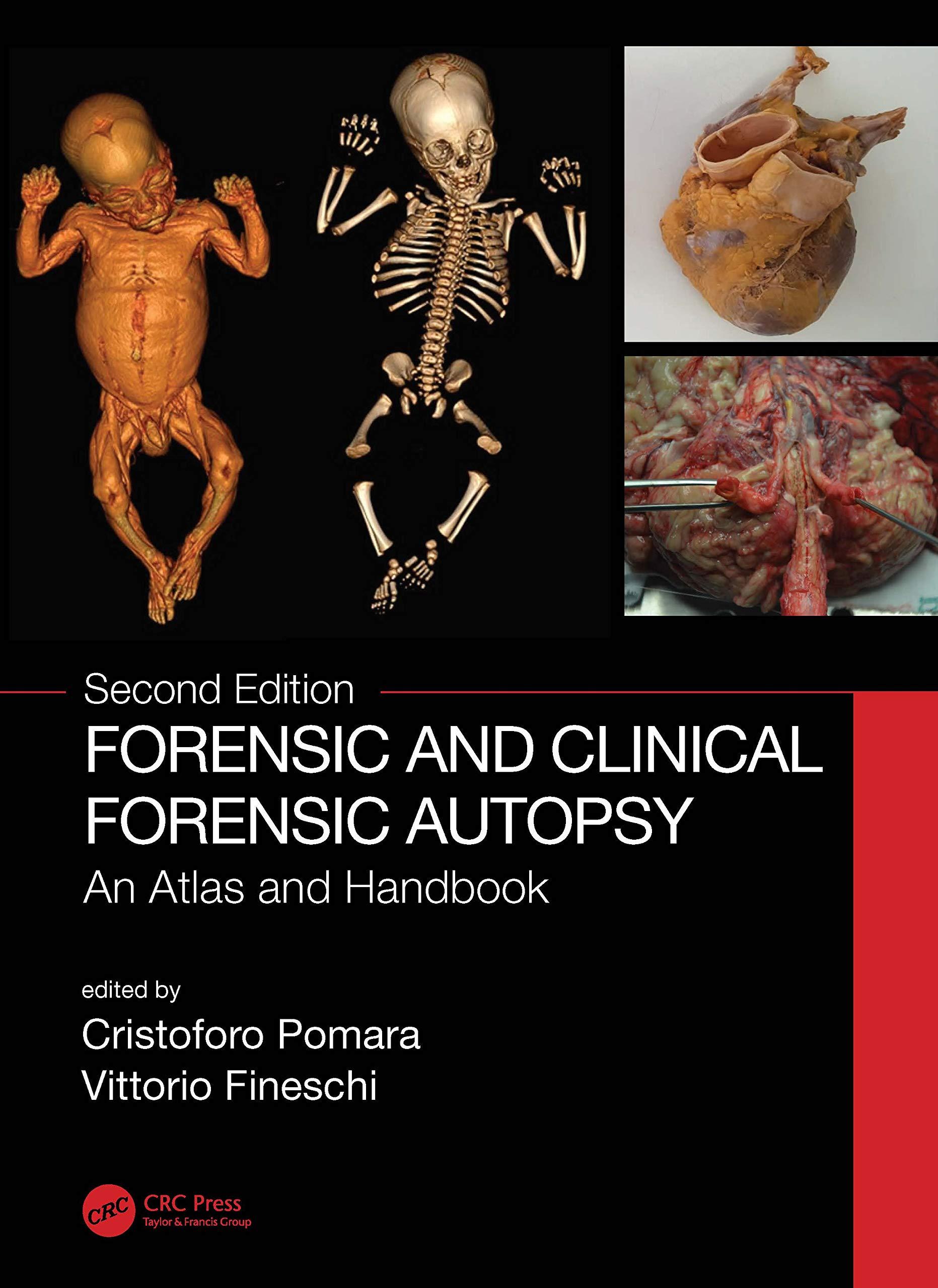 autopsy