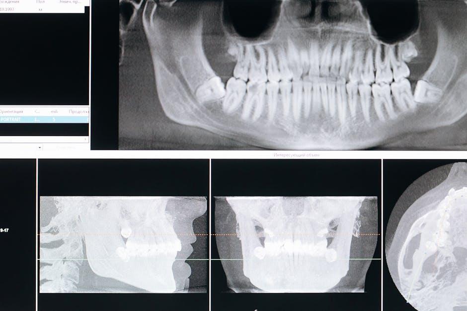 poor oral health