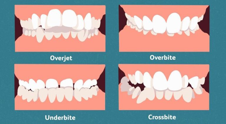 Overjet, A Harvard And MIT Dental Tech Startup, Applies AI To Improve Oral Care – Forbes