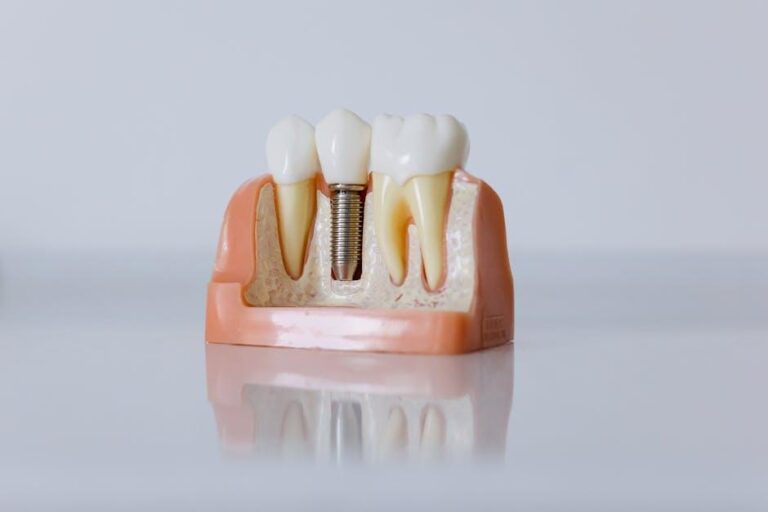 Be at the top of your cosmetic dental game – BDJ In Practice – Nature