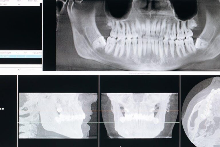3D Scans & Future Dental Tech with Zelko Relic, Align Technology – TechInformed