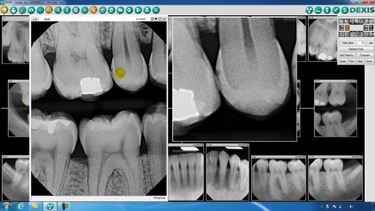 DEXIS unveils new dental imaging tech at IDS 2025 – Investing.com