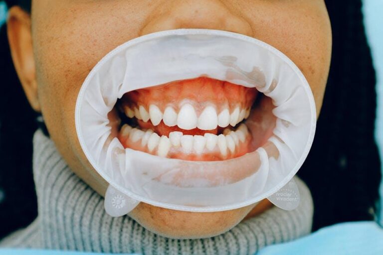 Poor Oral Health Potentially Linked To Chronic Health Problems – HealthDay