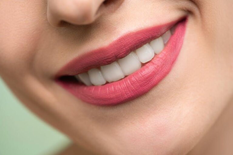 Smyle Dental Bakersfield Unveils Advanced Professional Teeth Whitening and Stain Removal Services – Barchart.com