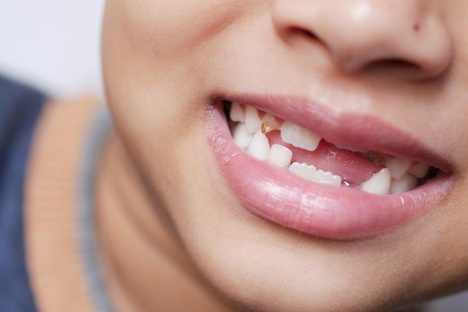FQHC dental gaps