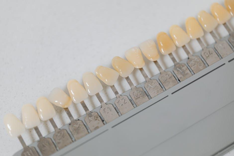 Porcelain veneers
